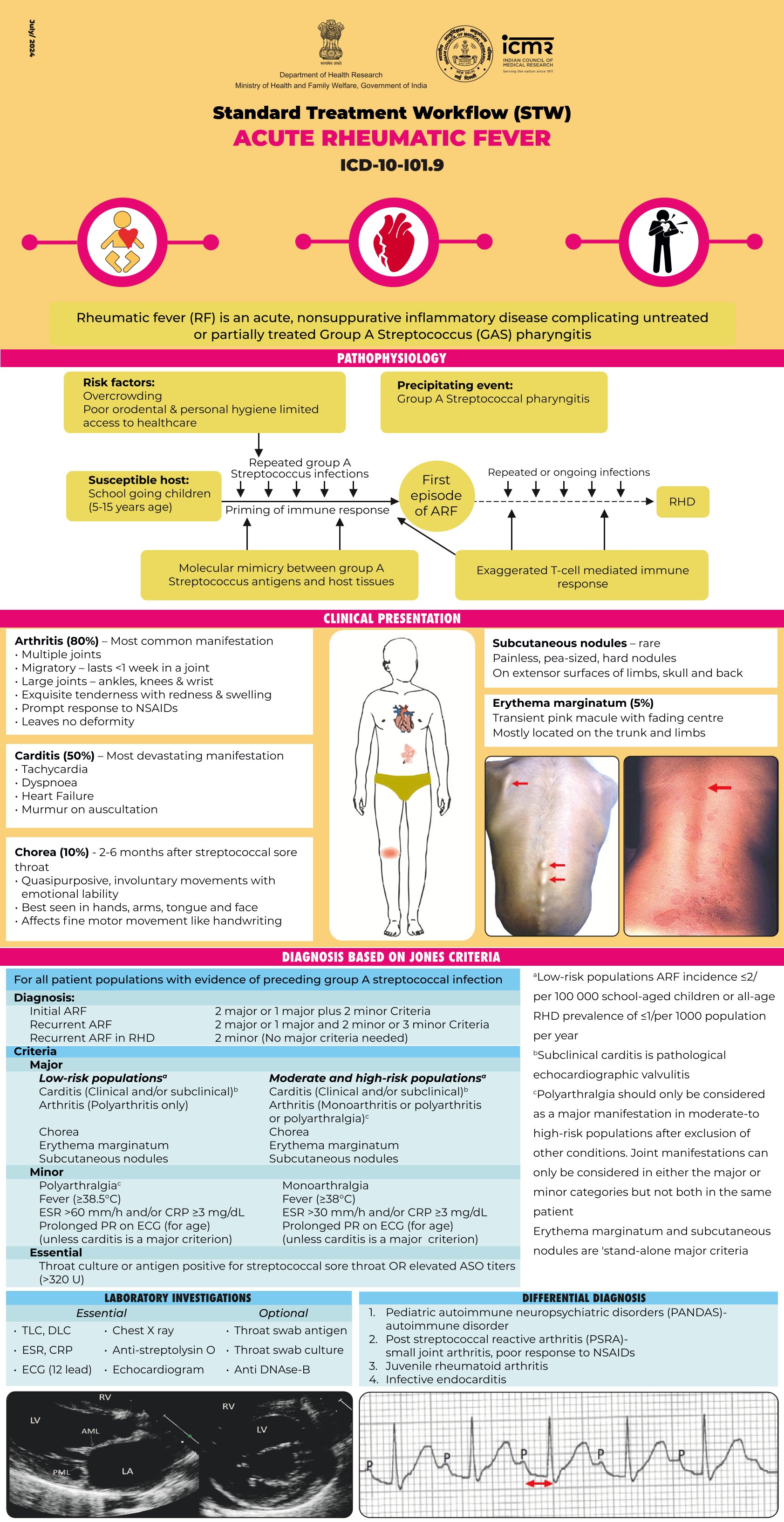 ACUTE RHEUMATIC FEVER
